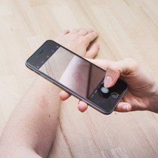 Bildausschnitt: eine Hand fotografiert mit dem Smartphone einen Hautausschlag an einem Arm